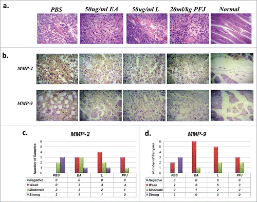 Figure 9. Immunohistochemistry staining for MMP2 and MMP9 and Hematoxylin-Eosin staining in different nude mice ovarian carcinoma tissues. The HE and immunohistochemistry staining in solid tumor paraffin sections. The result of MMP2: PBS (n = 5; moderate:2, strong:3), EA (n = 7; weak:3, moderate:3, strong:1), L (n = 7; weak:4, moderate:2, strong:1) and PFJ (n = 5; weak:4, moderate:1). And MMP9: PBS (n = 5; weak:2, strong:3), EA (n = 7; weak:6, moderate:1), L (n = 7; weak:5, moderate:2) and PFJ (n = 5; weak:3, moderate:2). It seems that all of three compounds may inhibit MMP9 expression strongly than MMP2.
