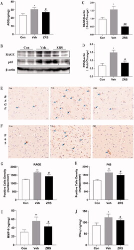 Figure 6. Effects of ZRS on the AGE-RAGE signalling pathway and downstream inflammatory cytokine activation after ACI. (A) Serum AGE levels measured using ELISA. (B) Representative images of RAGE and p65 levels detected using Western blotting. (C, D) The greyscale results for RAGE and P65 (/β-actin) levels. (E, F) Representative images of IHC staining for RAGE and p65 (×40; the arrow identifies a positive cell). (G, H) Positive expression of RAGE and P65. (I) Serum levels of MMP-9 detected using an ELISA. (J) Serum levels of IFN-γ detected using an ELISA. Control vs. vehicle, *p < 0.05 and **p < 0.01; ZRS vs. vehicle, #p < 0.05 and ##p < 0.01, n = 6 rats per group, means ± SEM.