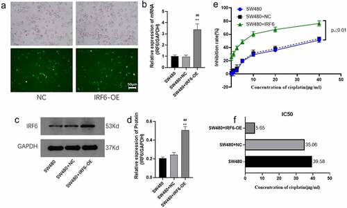 Figure 3. Cell viability of SW480 transfected with IRF6 overexpression (IRF6-OE) or NC plasmids. (a) SW480 was transfected with NC or IRF6-OE plasmids. (b) The mRNA expression of IRF6 in NC or IRF6-OE cells was measured using qPCR. (c) The protein expression of IRF6 in NC or IRF6-OE cells was measured using western blotting. (d) The relative protein expression of IRF6 was analyzed using ImageJ in gray. (e) Cell viability of NC or IRF6-OE cells was assayed using CCK8. (f) IC50 was analyzed using GraphPad Prism. ** p < 0.01 vs SW480. ## p < 0.01 vs SW480-NC. n = 3.