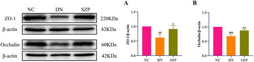 Figure 4. Sanziguben polysaccharides (SZP) improved tight junction proteins of gut barrier. Western blot analysis of (A) ZO-1 and (B) occludin proteins in colon tissue (n = 3, mean ± SD). ##p< 0.01, ###p< 0.001 vs. NC group; *p< 0.05, **p< 0.01 vs. diabetic nephropathy (DN) group.