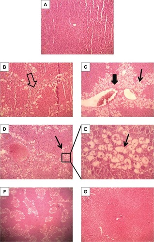 Figure 7 Hematoxylin–Eosin-stained liver section of normal and experimental rats.Notes: (A) Olive oil-treated control (100×) showing normal liver architecture. CCl4-treated control animals showing partial portal fibrosis (⇩) (B) (100×) and a significant number of fat-deposited cells (↓) along with portal inflammation and centrizonal necrosis (⬇) (C) (100×). (D) CCl4 + free Cur-treated animals (100×) showing some deformed cellular architecture with a large number of fatty acid-deposited cells, which is much clear with a higher magnification (400×) (E). CCl4 + lipo Cur treated (F) (100×) also showing some fat-deposited cells. (G) CCl4 + nano Cur treated (100×), showing architecture similar to normal.