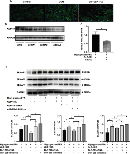 Figure 6 GLP-1RA affects the expression of SLMAP through miR-29b-3p. (A) Immunofluorescence staining of GLP-1R was performed on the heart sections of mice (n = 3). (B) GLP-1R expression in the H9c2 cells was inhibited by GLP-1R siRNA (n=3). (C) GLP-1R siRNA inhibited the expression of miR-29b-3p in H9c2 cells after H9c2 cells were treated with high glucose plus FFA combined with GLP-1RA (n = 3). *P <0.05 compared with GLP-1R siRNA control group (GLP-1R siNC). (D) Representative Western blot and quantification of SLMAP1-3 protein levels in H9c2 cells after treatment with high glucose/FFA, GLP-1RA, miR-29b-3p inhibitors or GLP-1R siRNA (n = 4). *P <0.05 compared with control group; #P <0.05 compared with high glucose/FFA group. †P <0.05 compared with high glucose/FFA+GLP-1RA group. Data are expressed as mean ± SD.