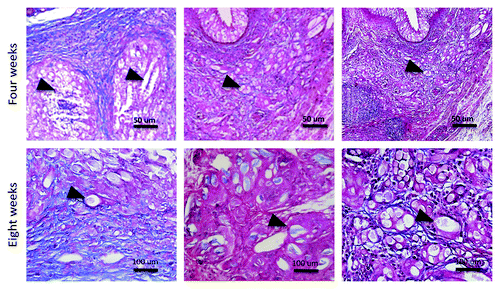 Figure 3. Characterization of fibrosis at the implant sites. (A) Masson’s Trychrome staining of control group (200×). (B) Masson’s Trychrome staining of ADSCs seeded scaffold (200×). (C) Masson’s Trychrome staining of MDSCs seeded scaffold (200×). (D) Masson’s Trychrome staining of control group (400×). (E) Masson’s Trychrome staining of ADSCs seeded scaffold (400×). (F) Masson’s Trychrome staining of MDSCs seeded scaffold (400×). Blue, collagen; black arrowheads, PGA scaffold.
