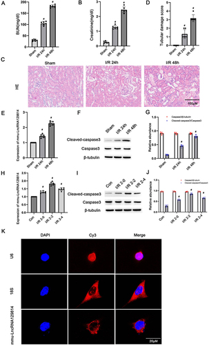 Figure 1 Ischemic AKI increases mmu-lncRNA129814 expression in BUMPT cells and C57/BL6J mice. The bilateral renal artery of C57/BL6J mice was clamped for 28 minutes followed by the reperfusion for 24 or 48 hours. BUMPT cells were exposed to I(2-h)/R(0/2/4-h). (A) BUN of the mice. (B) sCr of the mice. (C) H&E staining of mouse kidneys. (D) Tubular damage score (TDS). (E) qRT-PCR assay of mmu-lnRNA129814 in mouse kidney. (F) Immunoblotting of Casp3, Cle-Casp3, and tubB in mouse kidney. (G) The results of grayscale assessment. (H) qRT-PCR assay of mmu-lnRNA129814 in BUMPT cells. (I) Immunoblotting of Casp3, Cle-Casp3, and tubB in BUMPT cells. (J) The results of grayscale analysis. (K) FISH probe was applied to examine the localization of mmu-lncRNA129814 in BUMPT cells. U6 and 18S were employed as controls for nuclei and cytoplasms, respectively. Scale bar = 20 uM. Mean±SD (n = 6). #p < 0.05, I/R vs control or sham.