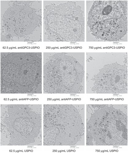 Figure S4 Hitach 7600 TEM demonstrates construction of the Hela cells, incubated with 750 μg/mL, 250 μg/mL, and 62.5 μg/mL iron content of antiGPC3-USPIO, antiAFP-USPIO, and USPIO for 4 h at 37°C in 5% CO2, with a magnification of 10,000.Note: The Hela cells took iron oxides increasingly in a concentration-dependent manner.