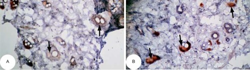 Figure 14 Photomicrographs of immunohistochemically stained breast tissue sections showing antiapoptotic marker, bcl-2 expression (indicated by the arrows) in normal control rats (A and B; ×400).