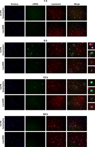 Figure 8 Intracellular trafficking of siRNA in BMDM. FAM-siRNA was used as donor for green fluorescence.Notes: Nuclei and lysosomes of BMDM were stained by Hoechst 33,342 and LysoTracker, respectively. Transfection type is indicated on the left of the graph, and time post-transfection is indicated on the top of the images. For merged images at 6 hours and 12 hours post-transfection, white boxes within the pictures are enlarged to the right of each respective image to show details of siRNA localization.