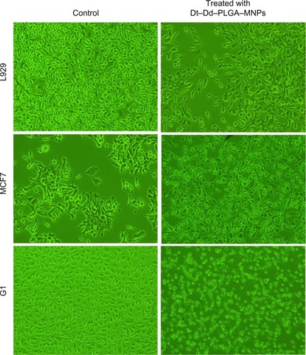 Figure 12 Phase contrast images of Dt–Dd–PLGA–MNP-treated cells.Notes: The control cells (L929) show healthy growing cells, whereas MCF7 and G1 cells display apoptotic behavior. The cancer cells were dead by 96 hours of nanoformulation exposure, whereas the control (L929) cells treated with the nanoformulation were highly viable with negligible cytotoxic effects.Abbreviation: Dt–Dd–PLGA–MNP, double targeted double drug loaded magnetic nanoparticle-encapsulated poly(D, L-lactic-co-glycolic acid) nanoparticles.