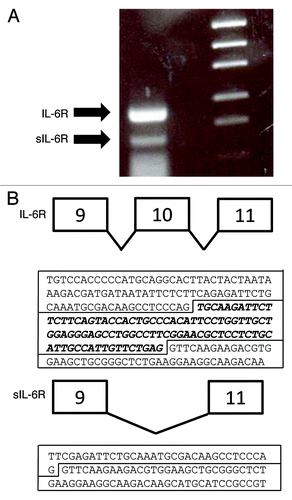Figure 1. Human islets express both membrane-bound and soluble isoforms of the IL-6R. (A) cDNA was generated from human islet RNA and amplified by RT-PCR using primers spanning exon 10 of the IL-6R [membrane-bound form (IL-6R): 265 bp; soluble form (sIL-6R): 171 bp]. Bands were separated by electrophoresis and visualized under long-wave UV illumination. (B) The identity of amplicons was confirmed by the direct sequencing of each excised band. The sequence of each amplicon is presented, with exon 10 emboldened.