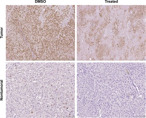 Figure 6 Representative immunohistochemistry of Ki67 in tumoral and nontumoral tissue of DMSO control group and in treated animals (magnification ×20).