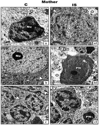 Figure 7. Transmission electron micrograph (TEM) through the basket (panel a&a1), Purkinje (panel b&b1) and granular (panel c&c1) cells of the cerebellar cortex of control (c) and IS mother rats respectively. Cellular images from control cerebellar cortex (a–c) appear with normal nucleus (N) and nucleolus (Nu), mitochodria (M), RER (arrow heads), SER (arrow), lysosomes (L). The cellular images from IS cerebellar cortex (a1–c1) there are pyknotic nuclei (PN), vacuoalted cytoplasm (white asterisks), dilated and de-granulated RER (double arrow heads), dialted Golgi bodies (black asterisk) and atrophied and vacuolated mitochondria (zigzag arrows). (Scale bar is indicated in the lower left handed side for each image).