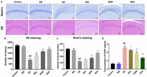 Figure 1. XYP protected hippocampus against CUMS-induced damage. A) The H&E and Nissl’s staining of brain sections; B) Number of neurons from HE staining; C) Number of neurons from Nissl staining; D) Serum concentrations of CORT. (## p ≤ 0.01 vs control group; * p ≤ 0.05 vs SD group; ** p ≤ 0.01 vs SD group).