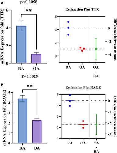 Figure 7 PBMC’s differential gene expression of TTR, RAGE between RA and OA. (A and B) Shows the increased significant gene expression of TTR (p<0.0058) and RAGE (p<0.0029) respectively in RA PBMCs compared to OA. The estimation plot of each groups shows a green dot indicates a difference between the mean of RA and OA, the green line represents the 95% confidence interval of that difference. The data are presented as mean ±SEM. The significance level indicates **< 0.01.