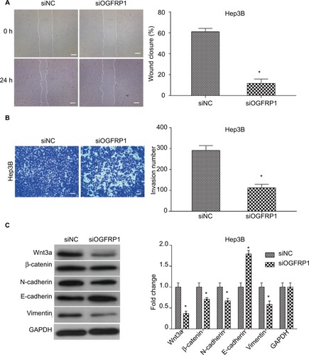 Figure 4 Downregulation of lncRNA OGFRP1 inhibits Hep3B cell mobility and EMT-associated Wnt/β-catenin signaling pathway.Notes: (A) Scratch assay confirmed that cell migration of Hep3B was significantly inhibited when transfected with siOGFRP1. Scale bar, 100 μm. (B) Transwell assay confirmed the anti-invasion action of siOGFRP1. Scale bar, 50 nm. (C) Western blot analysis of Wnt/β-catenin signaling pathway. All experiments were repeated three times. *P < 0.05.Abbreviations: lncRNA, long noncoding RNA; EMT, epithelial–mesenchymal transition; GAPDH, glyceraldehyde phosphate dehydrogenase.