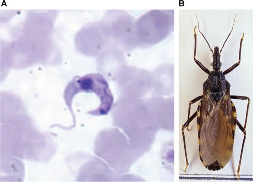 Figure 1 (A) Trypanosoma cruzi, the causative agent of Chagas disease. Reproduced from Centers for Disease Control and Prevention, part of the United States Department of Health and Human Services; 2004. Available from https://commons.wikimedia.org/wiki/File:Trypanosoma_cruzi_B.jpg.Citation36 (B) Triatoma infestans, the predominant vector of Chagas disease in the Southern Cone countries of South America. Reproduced from Wikipedians in Zoologische Staatssammlung München (ZSM); 2014. Available from https://commons.wikimedia.org/wiki/File:Triatoma_infestans_-_ZSM.jpg..Citation37