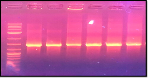 Figure 2. Gel electrophoresis of PCR products after amplification of 16S rRNA gene of P. acnes visualized under UV light. Lane1: 1 kb DNA marker; Lanes 2–6 are positive samples.