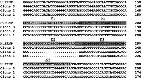 Figure 2. Comparison of the variations of nucleotide of PRNP gene of three different clones of the patients with the normal human PRNP gene