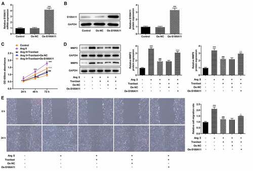 Figure 4. Overexpression of S100A11 reversed the inhibitory effect of Tranilast on AngII-induced overproliferation and migration of HCF cells. A. RT-qPCR detected the expression of S100A11 after cell transfection. B. Western blot detected the expression of S100A11 after cell transfection. ***P < 0.001 vs Oe-NC. C. CCK-8 assay detected the cell viability of AngII-induced cells after induction with different concentrations of Tranilast and cell transfection. D. Western blot detected the expression of MMP2 and MMP9. E. wound healing detected the migration of cells. ***P < 0.001 vs control; ###P < 0.001 vs Ang II; ΔP<0.05, ΔΔP<0.01, ΔΔΔP<0.001 vs Ang II + Tranilast + Oe-NC