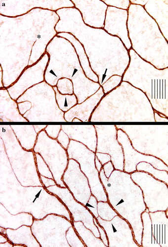Figure 1.  Immunohistochemical visualization of microvessels in the mesenteric window of a rat receiving a continuous infusion for seven days of paclitaxel at 16 mg/kg/w (a) and cremophore vehicle (b). Arrows indicate an intersection, while arrowheads indicate interconnecting loops (not all intersections and loops are indicated) and asterisks indicate sprouts although the field of view is not from the edge of the microvascular tree. Note the lower density of microvessels in a. The distance between two adjacent lines is 10 µm.
