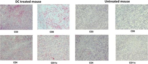 Fig. 4.  Immunohistology of tumour material taken from a mouse treated with DCs (representative for exosome and tumour lysate-DC group) (day 52) and a non-treated tumour bearing mouse (day 15). CD3, CD4 and CD8 were used to stain different subsets of T cells (positive cells=red). CD11c was used to stain DCs.