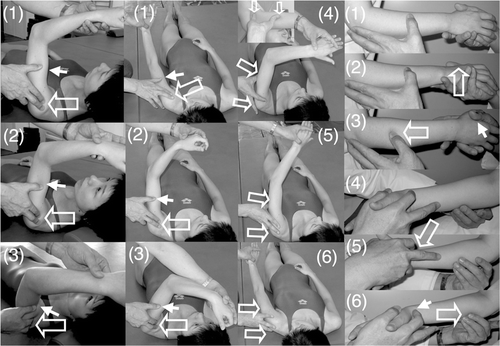 Figure 2. Shoulder flexion, shoulder adduction/flexion/internal rotation (modified PNF) and forearm supination/pronation with elbow flexion. (Left column) To facilitate shoulder flexion, the therapist tapped the anterior part of the deltoid muscle (1) and pushed the skin on the humeral head with his fingers to avoid its elevation (2) and supported or resisted the brachium by his thumb (3). (Middle two columns) To facilitate shoulder flexion/adduction/external rotation with flexing of the elbow and forearm supination accompanied by wrist flexion and finger flexion, the therapist quickly performed shoulder extension/abduction/internal rotation with extension of the elbow and forearm pronation accompanied by wrist dorsiflexion and finger extension (1), tapped the inside of the deltoid muscle (2) and provided support or resistance with his other hand (3). When the patient had achieved shoulder flexion/adduction/external rotation with flexion of the elbow, forearm supination accompanied by wrist flexion and finger flexion, the therapist quickly flexed the patient's wrist, pushed the tricepus blaki muscle and its tendon with the therapist's fingers to elicit elbow extension (4) and provided support by the therapist's other hand to the movements of shoulder extension/abduction/internal rotation (5), elbow extension/forearm pronation/wrist dorsiflexion/finger extension (6). (Right column) To facilitate forearm supination/pronation with 90° elbow flexion in the sitting position, the therapist held the hand of the patient and placed the thumb of his other hand on the dorsal forearm (1), quickly pronated the forearm (2), rubbed the dorsal forearm with his thumb and provided slight resistance by his hand (3). To facilitate forearm pronation, the therapist held the hand of the patient (4), tapped with his second finger the radial wrist for quick supination of the forearm (5) and rubbed the ventral forearm using his third and fourth fingers (6). The open arrow and closed arrow indicate manipulation of the stretch reflex and light touch (resistance) to maintain the α–γ linkage, respectively.
