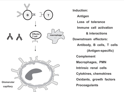 Figure 1 Pathogenesis of glomerulonephritis. Animal models suggest that autoimmunity underlies pathogenesis of most GN. Disease initiation requires loss of tolerance and activation of self-reactive lymphocytes. Activated B and T cells interact to promote autoantibody and cytokine production, immune complex formation, antibody deposition, macrophage and neutrophil recruitment, renal inflammation, and activation of renal endothelial, mesangial, epithelial and tubular cells. Glomerular and tubulointerstitial antigens may be specifically targeted by autoantibodies and self-reactive CD4 and CD8 TCR alpha/beta effector T cells, gamma/delta T cells and NKT cells. Numerous soluble and cellular mediators participate in subsequent tissue inflammation, injury and repair, and modulate local renal immune responses. The predominant cells and molecules engaged vary depending on the etiology and site of glomerular injury.