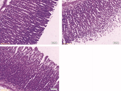Figure 2. Effects of rutin on histological findings of gastric damage induced by I/R in rats after HE stain: sham (A), I/R control (B), rutin (200 mg/kg) (C). Rutin was given by gavage 60 min before the experiment.