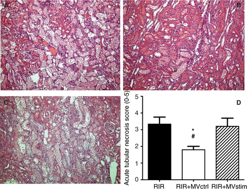 Fig. 6.  Effects of MV treatment on acute tubular necrosis (ATN) in rats with renal ischemia-reperfusion injury. (A) Representative photomicrographs from untreated rats with I/R injury. (B) Representative photomicrographs from rats with I/R injury treated with MVctrl. (C) Representative photomicrographs from rats with I/R injury treated with MVstim. Magnification ×200, scale bar 100 µm. (D) Quantification of ATN with a scoring system. RIR denotes rats with renal I/R injury; RIR+MVctrl, rats with I/R injury treated with control microvesicles after reperfusion; RIR+MVstim, rats with I/R injury treated with interferon-γ microvesicles after reperfusion; *p<0.05 RIR+MVctrl vs. RIR; #p<0.05 RIR+MVctrl vs. RIR+MVstim.