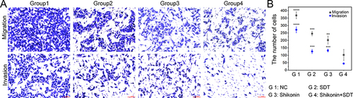 Figure 5 Detection of HepG2 cells migration and invasion ability changes after different treatments (scale bar: 100 μm). (A) Representative images of HepG2 cells with migration and invasion ability after different treatments. (B) Quantitative analysis of cells with invasive and migration capacity at the bottom of the upper chamber. **p < 0.01, ***p < 0.001, ****p < 0.0001.