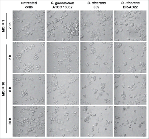 Figure 6. Detachment of THP-1 cells infected with C. ulcerans. Cells infected with non-pathogenic C. glutamicum or pathogenic C. ulcerans at an MOI of 10 and 1 were analyzed microscopically at 2, 8 and 20 h post-infection, untreated cells served as negative control. Both C. ulcerans wild type strains caused detachment of cells at MOI 10 after 8 h, and an increasing effect with longer incubation time. Cells treated with C. glutamicum looked healthy even after 20 h, as well as cells incubated with a lower amount of bacteria (MOI 1).