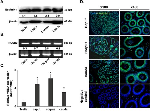 Figure 1. NUCB2 mRNA and nesfatin-1 protein expression in the mouse epididymis. (A) Conventional RT-PCR analysis revealed the presence of NUCB2 mRNA in the testis and the caput, corpus, and cauda of epididymis. (B) Western blotting showed the existence of nesfatin-1 protein in the same samples. (C) NUCB2 mRNA expression levels were analyzed in the same samples by qRT-PCR. The expression levels were higher in all regions of the epididymis than in the testis. (D) Localization of nesfatin-1 protein in the epididymis. Nesfatin-1 protein was expressed in many epithelial cells in the caput, corpus, and cauda of the epididymis. Original magnification, 100× and 400×. A statistically significant difference was considered when p < 0.05 compared to the testes (* p < 0.05).