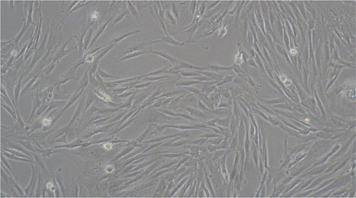 Figure S1 Primary OS cells.