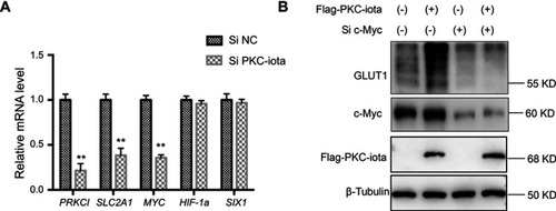 Figure 3 PKC-iota regulates GLUT1 via modulating c-Myc expression. (A) A549 cells were transfected with Si NC or Si PKC-iota for 36 h. The mRNA levels of the indicated genes were analyzed by real-time PCR. **means a P-value <0.005. (B) H1650 cells were co-transfected with Flag-PKC-iota (or empty vector) and Si c-Myc (or Si NC) for 72 h. Then, the cell lysates were immunoblotted with the indicated antibodies. β-Tubulin served as the loading control.