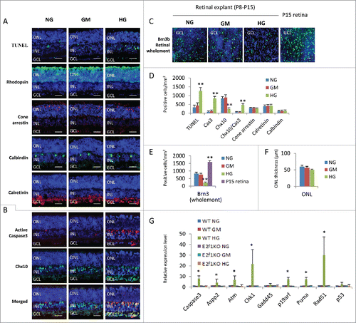 Figure 1. High glucose induced excitatory neuronal death in retinal explants. (A) Sections from P8 retinal explants cultured for 7 days under indicated conditions were stained for nuclei (DAPI, blue), cell death (TUNEL, green), rod photoreceptors (Rhodopsin, green), cone photoreceptors (Cone arrestin, red), horizontal cells (Calbindin, green) and amacrine cells (Calretinin, green). (B) Sections from P8 retinal explants cultured for 7 days under indicated conditions were stained for nuclei (DAPI, blue), apoptosis (active caspase 3, red) and bipolar cells (Chx10, green). (C) Wholemont retinas from P8 retinal explants cultured for 7 days under indicated conditions, and P15 wild type (WT) retina were stained for nuclei (DAPI, blue) and ganglion cells (Brn3, green). (D) Quantification of TUNEL+ cells, active caspase 3 (cas3)+ cells, Chx10+ bipolar cells, Chx10+/Cas3+ dying bipolar cells, Cone arrestin+ Cone cells, Calretinin+ amacrine cells and Calbindin+ horizontal cells per mm2 retinal section area. (E) Quantification of Brn3+ ganglion cells per mm2 of wholemont of retinal explants and P15 WT retinas. (F) Quantification of the thickness of ONL of retinal explants (μm). (G) The relative expression level of indicated genes in retinal explants by RT-PCR. Error bars represent SD of measurements from at least three animals and asterisks indicate significant differences between retinas of NG group (D, E, F) or WT NG group (G) and the indicated groups (*, p < 0.05, **, p < 0.01, t test). Scale bar = 50 μm. NG: normal glucose control (7.5 mM); GM: osmotic control (7.5 mM glucose+27.5 mM Mannitol); HG: high glucose (35 mM). ONL: outer nuclear layer; INL: inner nuclear layer; GCL: ganglion cell layer.