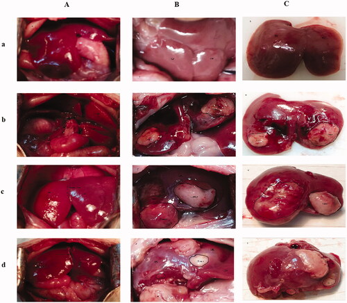 Figure 1. Surgical procedure images. (A) The associating liver partition and portal vein ligation (ALPPS) procedure in rats with orthotopic liver cancer: (a) exposure of the liver after laparotomy; (b) ligation of the portal vein branches. The silk knots (symbols on the image) represent the ligated portal vein (PV); 1 represents the PV of the right lobe (RL); 2 represents the hepatic pedicle of the caudate lobe (CL) and resected CL; 3 represents the PV of the left median lobe (LML) and left lateral lobe (LLL); (c) an ischaemic line emerging slightly to the right of the falciform ligament; (d) the median lobe (ML) was split in situ along the ischaemic line and implanted tumour tissue. (B) Exposure of the liver at POD15; (a) group 1, showing a normal liver; (b) group 2, showing the tumour observed within the LML and RML; (c) group 3, showing the future liver remnant (FLR) (RML) regeneration and the enlarged tumour observed within the LML and RML; (d) group 4, showing FLR (RML) regeneration and a reduced tumour within the LML and RML. (C) The resected ML; (a) group 1, the mock group; (b) group 2, the implantation without ALPPS group; (c) group 3, the implantation/ALPPS group; (d) group 4: the implantation/ALPPS/CA group.