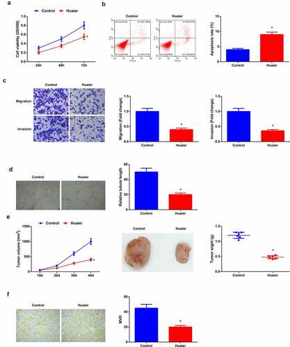 Figure 1. Huaier constrains LC angiogenesis and tumor growth in vivo and in vitro. (a) CCK-8 detection of cell proliferation; (b) Flow cytometry detection of cell apoptosis; (c) Transwell detection of cell migration and invasion; (d) Matrigel tube formation test of the angiogenesis ability (200 ×); (e) Tumor volume and mass (n = 6); (f) Immunohistochemical characterization of CD31 protein and calculation of angiogenesis (n = 6); Expression of the values was as mean ± SD (N = 3 in cell experiments). In the Control and the Huaier groups. * vs. the Control, P < 0.05. Attached Figure 1 Down-regulation of let-7 family expression is presented in LC A. qRT-PCR to detect let-7 family expression level in LC; B. qRT-PCR to detect let-7d-5p expression levels in immortalized human lung cell line Beas-2B and LC cell lines (A549, H460, H1299, H1650 and H1975). The values were expressed as mean ± SD (cell experiments were repeated 3 times independently). One-way ANOVA was applied to calculate the significance of each group. The variance was corrected by Tukey test. * vs. the Normal group, P < 0.05. 0.05.