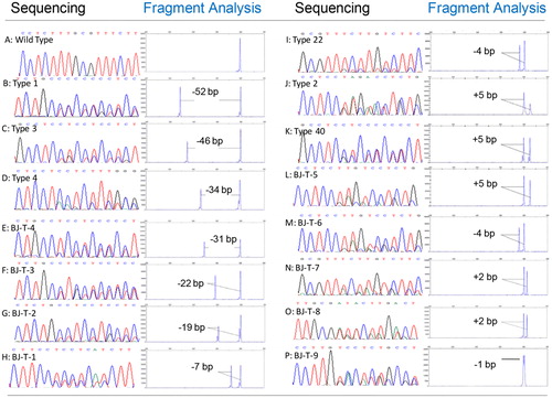 Figure 3. Sequencing traces show heterozygous mutation of CALR. Gene scan electropherogram from the PCR method and partial sequence of CALR exon 9 from the sequencing method (numbering according to GenBank access number: NC_000019.9). A-P: Detected a wild-type and 15 CALR mutation types by sequencing and fragment analysis methods. A: wild-type, B-I: deletions, H-L: insertions, M-P: complex indels.