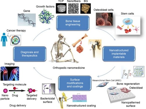 Figure 1 Scheme shows potential applications of nanomedicine in orthopedic medicine.Abbreviations: BG, bioactive glass; TCP, tricalcium phosphate.