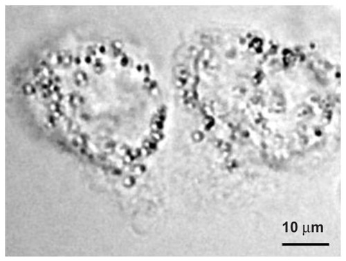 Figure 3 Phase contrast image of the A431 cells before laser illumination.Note: The polylactic acid spheres with a diameter of 2000 nm conjugated to the surface of the cells.