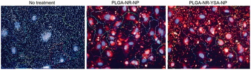 Figure 3. Fluorescence images showing 6-h uptake of nanoparticles by human umbilical vein endothelial cells (HUVEC) cells. High magnification images of HUVEC cells obtained using Operetta high-content imaging system (PerkinElmer, Waltham, MA) at 6 h after treatment with 0.5 mg/ml of nanoparticles with or without YSA-functionalization. Blue stain indicates the cell nucleus, red indicates the Nile red dye, and multicolored lines indicate the cell boundaries.