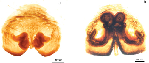 Figure 3. Epigyne (ventral view) of Piratula hygrophila in: (a) female parasitized by a mermithid, (b) unparasitized female. Photo by U. Jabłońska.