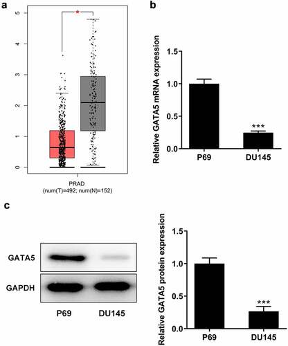 Figure 4. GATA5 expression is downregulated in PCa tissues and cells. A, Data in GEPIA database showed downregulation of GATA5 in PCa. mRNA (b) and protein levels (c) of GATA5 in normal prostatic epithelial cells and DU145 cells were detected. Data are expressed as mean ± SD. *P < 0.05, ***P < 0.001 versus control.