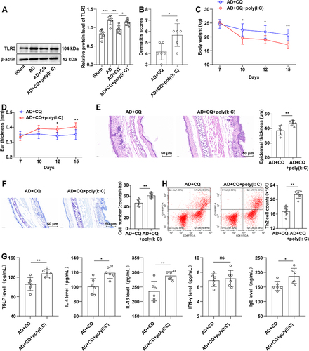 Figure 2 CQ abated type 2 inflammatory response in AD mice by inactivating TLR3. (A) Western blot detection of TLR3 protein expression; (B) the severity of ear skin lesions; (C) dermatitis severity score; (D) left ear thickness; (E) H&E staining; (F) TB staining; (G) ELISA detections of serum TSLP, IL-4, IL-13, IFN-γ, and IgE levels; (H) flow cytometry to assess the content of Th2 cells (CD3+CD4+CD193+). N = 6. Data were represented as mean ± standard deviation. Data in panel A were tested by one-way ANOVA, followed by post hoc testing using Tukey’s test. Two-way ANOVA was used for panels (C and D), and Šídák’s multiple comparisons test was used for post hoc test. Data in panels B/E-H were examined by independent sample t-test. ns represented P > 0.05, *P < 0.05, **P < 0.01, ***P < 0.001.