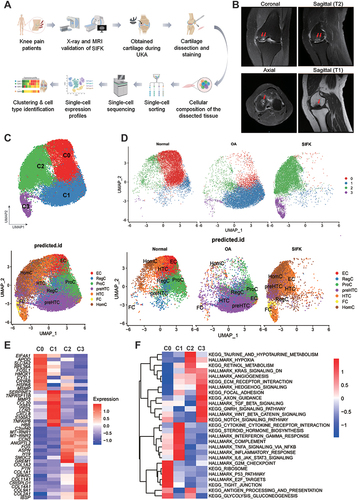 Figure 1 Single-cell RNA-sequencing (scRNA-seq) demonstrates reprogramming of SIFK cartilage. (A) Schematic of the experimental workflow used for scRNA-seq. (B) T2/T1-weighted MRI (coronal, sagittal, and axial views) showing a classic subchondral insufficiency fracture of the medial femoral condyle of the left knee joint. Red arrows show a diffuse high/low signal intensity in the medial femoral condyle. (C) Upper panel: UMAP plot of integrated datasets of chondrocytes from normal, OA, and SIFK cartilage, and the cell clusters are denoted as C0, C1, C2, and C3. Lower panel: Predicted identification from labeling transfer of GSE104782 (D) Upper panel: Split view of the integrated UMAP plot showing the differential clustering pattern of normal, OA, and SIFK cartilage. Lower panel: Split view of predicted identification from labeling transfer of GSE104782 (E) Heatmap illustrating the top 10 differentially expressed genes (DEGs) (p ≤ 0.05, fold change ≥ 1.5) in each cluster (C0-C3). (F) Heatmap showing the scaled pathway activities in each cluster.