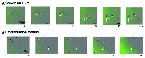 Figure 3. Live imaging reveals differences in cell-fate between progeny of asymmetrically dividing inclusion body cell. (A) Example of an inclusion body cell (arrowhead) in maintenance medium that undergoes cell division (GFP is labeled in green). The progeny that does not inherit the inclusion body (arrow) divides before the cell that received the inclusion body (arrowhead) (n = 16). (B) Example of an inclusion body cell (arrowhead) in differentiation medium that undergoes cell division (GFP is labeled in green). Neurite length is longer in the cell that inherits the inclusion body (n = 15).