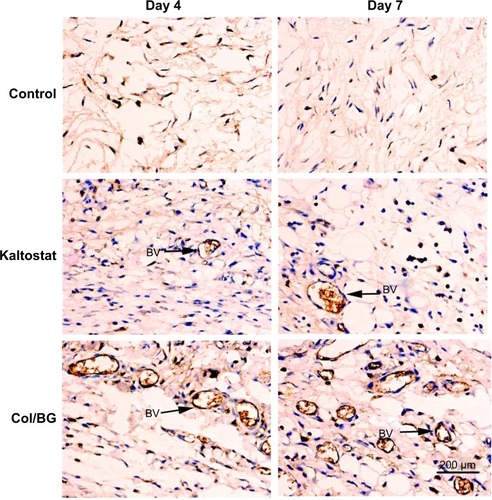 Figure 9 Immunostaining (CD31) of wound sections treated with the Col/BG nanofibers or Kaltostat at days 4 and 7. Untreated wounds were used as controls. Magnification ×500.Abbreviations: BV, blood vessel; Col/BG, collagen/bioactive glass.