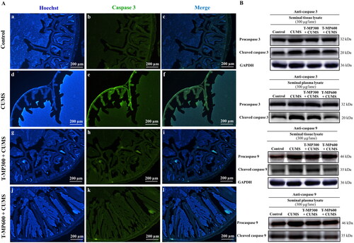 Figure 5. Immunofluorescence staining of seminal vesicle against anti-caspase 3 (A). Nuclei stained by Hoechst 33342 (blue-emitting fluorescent). Expression of pro and cleaved caspases 3 and 9 in rat seminal tissue and plasma lysates compared among control, CUMS and treated groups (B) (n = 8, each group).