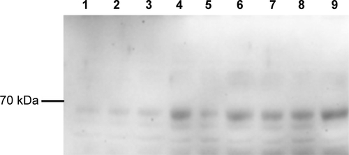 Figure S1 A549 cell lysates probed for citrullinated proteins after treatment with Cd-containing materials.Notes: Lanes, left to right, 1, no treatment; 2, CdCl2; 3, CdO; 4, pre-combustion CdCl2 + ufCB; 5, pre-combustion CdO + ufCB; 6, post-combustion CdCl2 + ufCB; 7, post-combustion CdO + ufCB; 8, ufCB; 9, CdTe quantum dots.Abbreviations: Cd, cadmium; CdO, cadmium oxide; CdCl2, cadmium chloridel; ufCB, ultrafine carbon black.