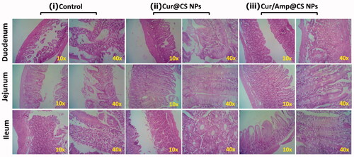 Figure 7. Histological images (HE staining) of in vivo intestinal morphology of different sections such as duodenum, jejunum, and ileum tissues after treated with (i) control, (ii) Cur@CS NPs, and (iii) Amp/Cur@CS NPs (magnifications ×10 and ×40).