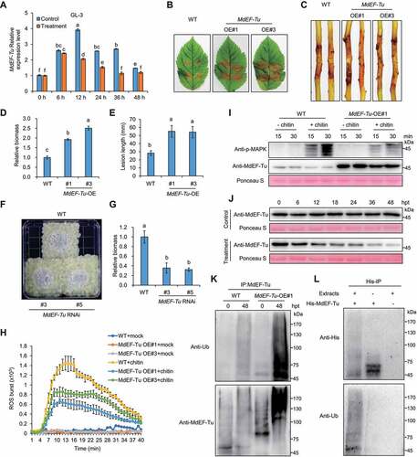 Figure 3. MdEF-Tu negatively regulates V. Mali resistance and is ubiquitinated and degradated upon infection. (A) The relative transcript levels of MdEF-Tu in GL-3 at different stages during V. Mali infection. (B and C) Representative disease symptoms of detached leaves and stems in GL-3 (WT) and transgenic lines overexpressing MdEF-Tu (OE#1 and OE#3) infected with V. Mali and photographed at 3 d and 7 d, respectively. (D and E) Statistical analysis of the relative fungal biomass of diseased leaves in (B) and the length of the necrotic regions of stems in (C). (F) Representative disease symptoms of WT and its transgenic calli with MdEF-Tu silenced (RNAi#3 and RNAi#5) under V. Mali infection; photographs were taken at 3 d. (G) Relative fungal biomass of V. Mali was determined by RT–qPCR in infected calli. Data represent means ± SD, n = 3. Different letters indicate significant differences at P < 0.05 based on one-way ANOVA followed by Tukey’s test. (H) MdEF-Tu overexpression suppressed chitin-induced ROS burst. Data represent means ± SD, n = 6. (I) MdEF-Tu overexpression suppressed chitin-induced MAPK activation. (J) Immunoblotting of MdEF-Tu stability at the indicated times under control or treatment conditions in MdEF-Tu overexpressing leaves. (K) Ubiquitination of MdEF-Tu in vivo upon V. Mali infection. The Ubiquitination of MdEF-Tu protein in both WT and MdEF-Tu OE#1 line during V. Mali infection was detected by immunoprecipitation analysis with anti-Ub and anti-MdEF-Tu antibodies. (L) Ubiquitination of MdEF-Tu in vitro. Purified recombinant protein His-MdEF-Tu was incubated with or without equal amounts of protein extracts from GL-3-infected leaves and was pulled down using a His-Select Nickel Affinity Gel.